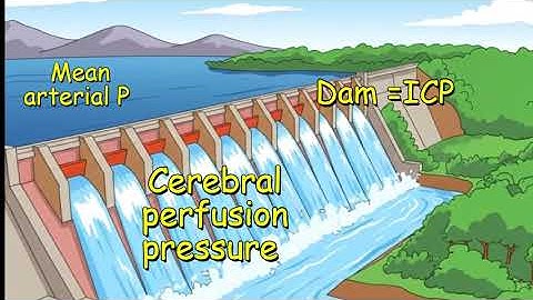 MAP ICP and Cerebral perfusion pressure