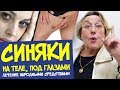 СИНЯКИ на теле без причины || лечение народными средствами