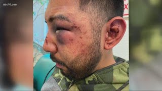 Stockton man seeks justice after he says officers in jail brutally beat him | Daily Blend