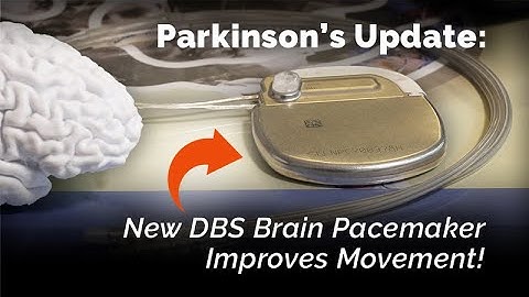New DBS Brain Pacemaker Improves Movement for People with Parkinson