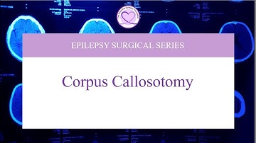 A Brain Surgery You Never Knew Existed: The Power of a Corpus Callosotomy!