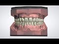 3Shape Dental System - Full Denture Design