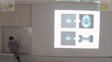 Functional MRI -- The art of data acquisition (Part I)