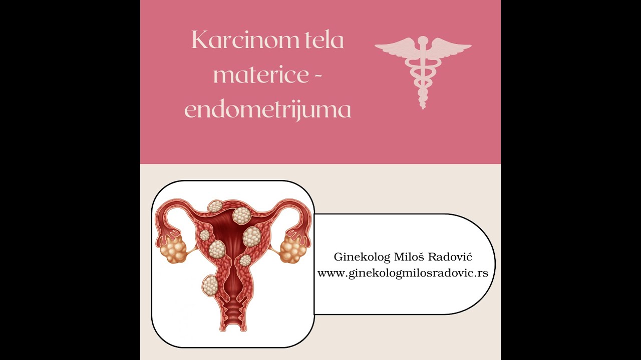 Karcinom tela materice (endometrijuma)