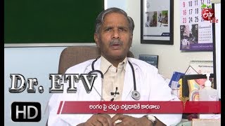 Circumcision | Dr ETV | 22nd June 2019 | ETV Life