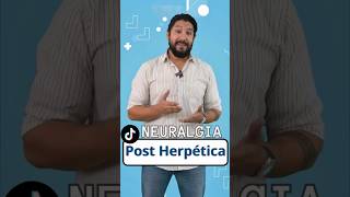 Neuralgia Por Herpes Zoster