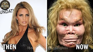 20 Celebrity Plastic Surgery Disasters | You’d Never Recognize Them After Plastic Surgery Gone Wrong