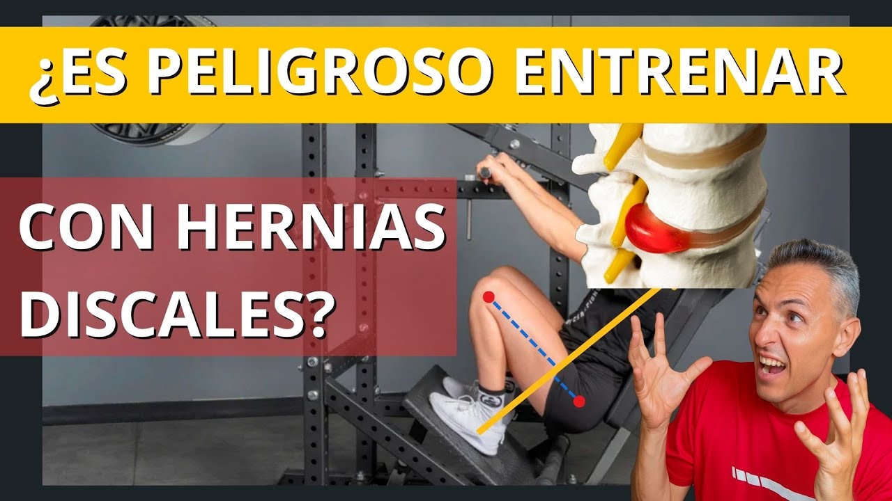 PELIGROS de Entrenar con Hernias Discales 💪💪💪