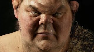The Man Who Ate Half a Cow The Bizarre Story of Tarrare the Insatiable Hunger