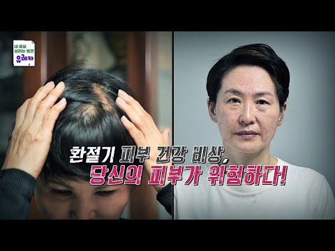 환절기 피부 건강 <strong>비상</strong>, 당신의 피부가 위험하다!_내 몸을 살리는 유레카 88회 <strong>예고</strong> TV CHOSUN 221030 방송