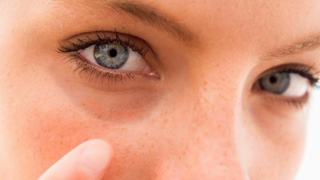 Волшебный крем для глаз своими руками/Прощай, морщины, темные круги и мешки под глазами за 2 дня!