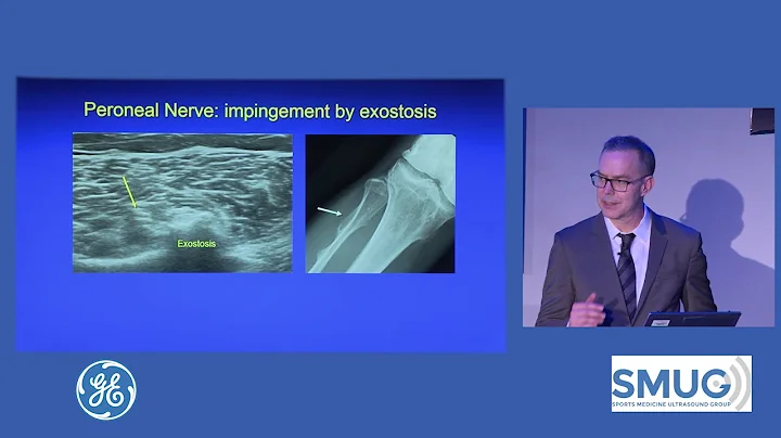 SMUG Jon Jacobson Masterclass 2019. MSKUS lower li...