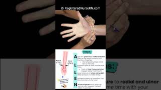 Modified Allen Test Demonstration & Nursing Mnemonic #nursing #nurse #rn #nursingschool