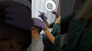 Mezoterapia Mikroigłowa - Dermapen, Zapraszamy Do Gabinetu Trycho-Medica.pl