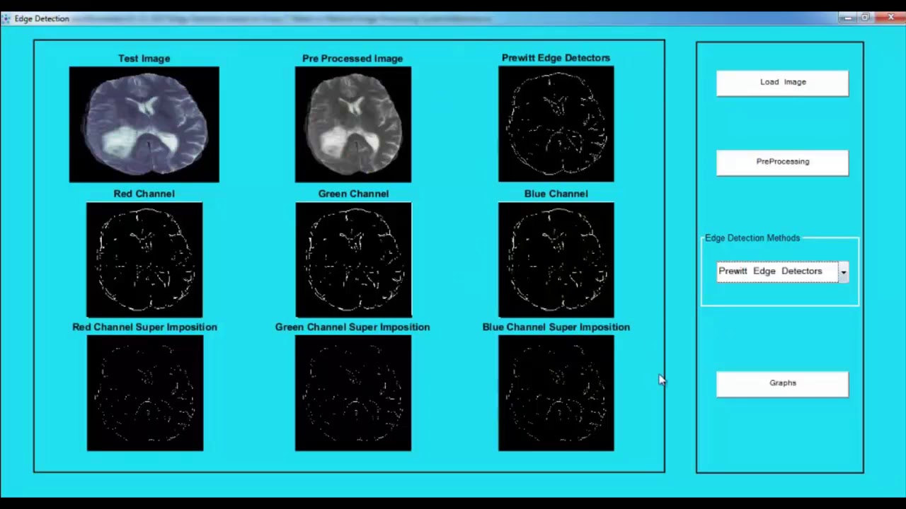Image Processing Project Documentation | Image Processing Thesis ...