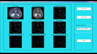 Image Processing Project Documentation | Image Processing Thesis Documentation