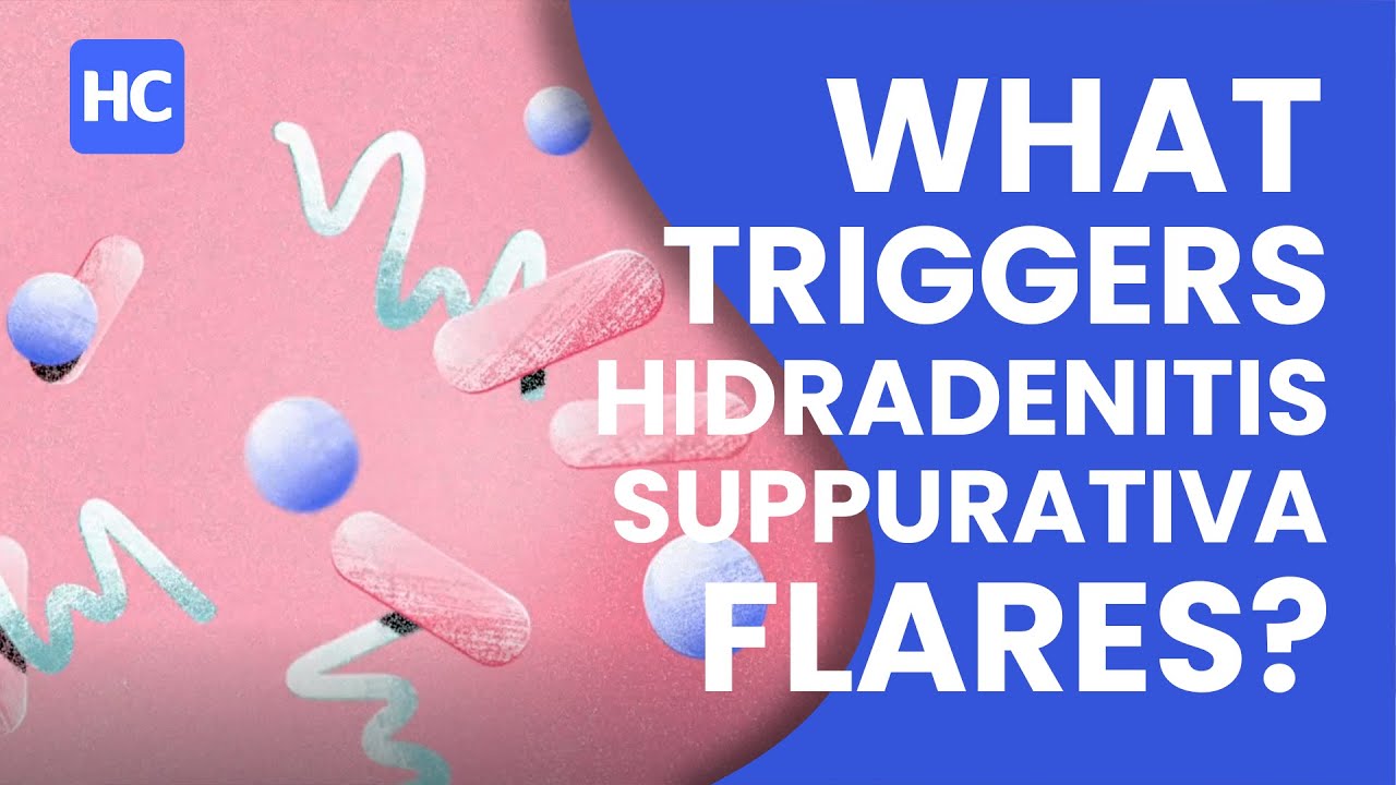 What Triggers HS Flares?
