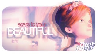 [dgs] félicie | scars to your beautiful. { mep part };;