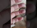 Too much pain
