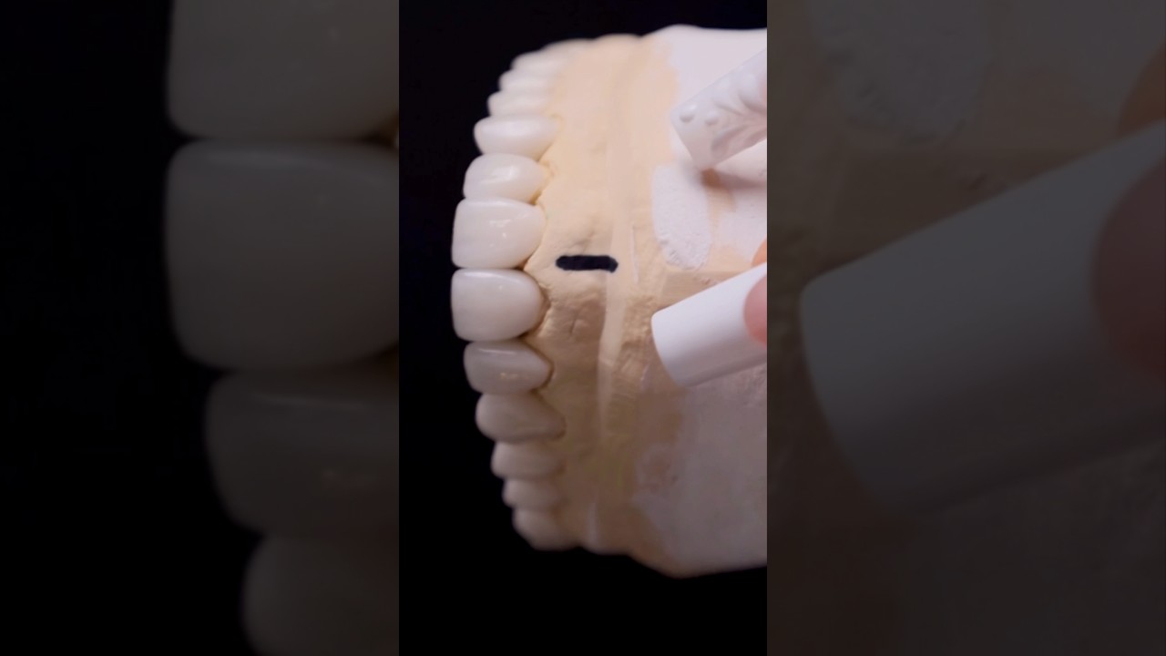 The art of dentistry….          #drshawnkeller #cosmeticdentistry #viral