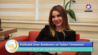 Polikistik over sendromu nedir, nasıl tedavi edilir? Dr Çağdaş Aslan