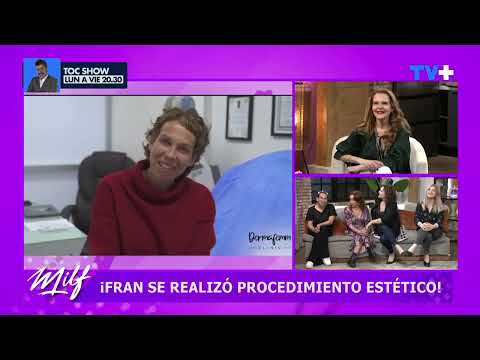 ¡Fran Conserva se realizó un procedimiento estético!