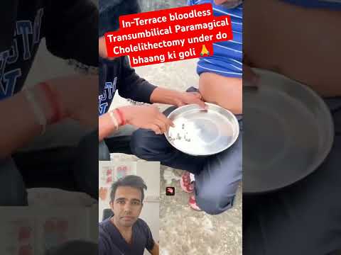 New magical procedure for gall stones