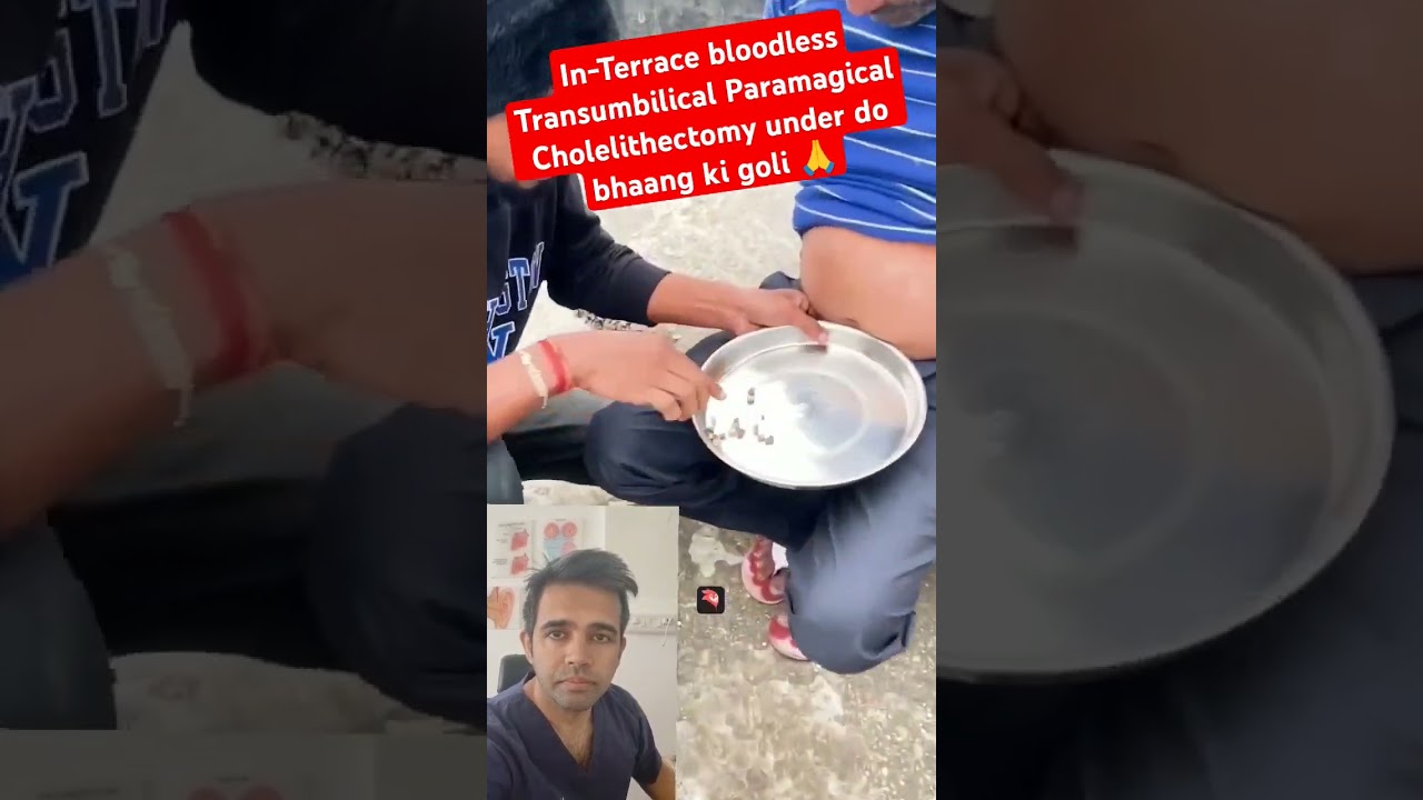New magical procedure for gall stones #medicaldegree #medicos