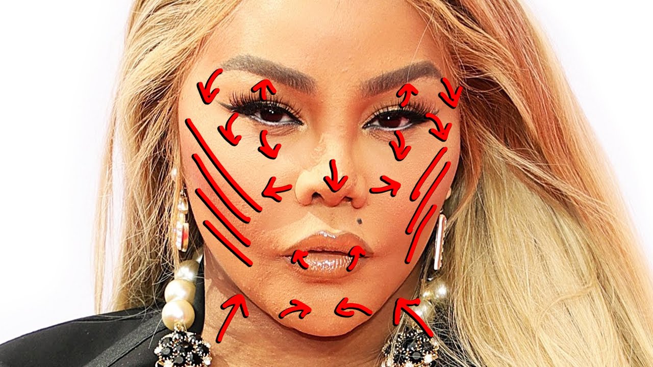 Удаление пластической операции LIL' KIM