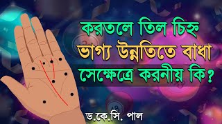 করতলে তিল চিহ্ন ভাগ্য উন্নতিতে বাধা সে ক্ষেত্রে কি করবেন? Astrologer-K.C.Pal | Hater till chinno screenshot 1