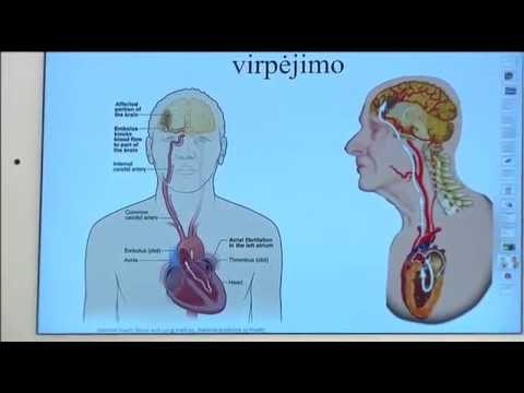 Video: Portalo Venų Trombozė (PVT): Simptomai, Priežastys Ir Gydymas