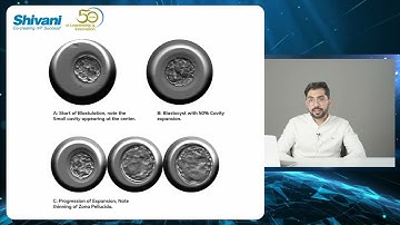 Embryo Selection - Dr. Keshav Malhotra