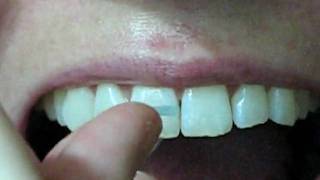 Famous You're Flossing Wrong. Floss Using The C-Shaped Method. Profile