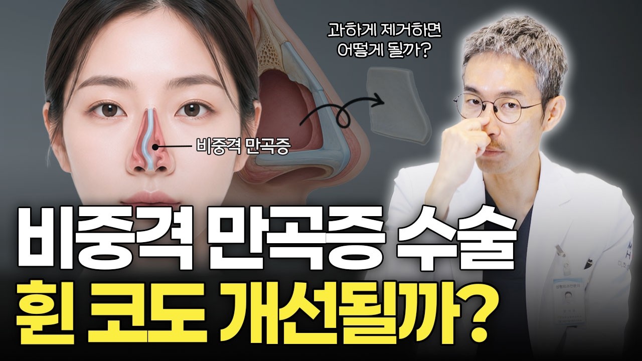 비중격 만곡증 꼭 수술해야 하나요?👃🏻 Q&A 모든 궁금증 답해드립니다!🙋🏻♀️