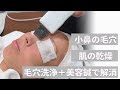 【毛穴洗浄＋美容鍼】気になる小鼻の毛穴、肌の乾燥がモチモチ美肌に！[40代 50代]