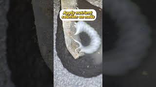 Fingernail Under The Microscope