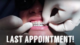 VLOG : 23 months braces update || my last appointment !!