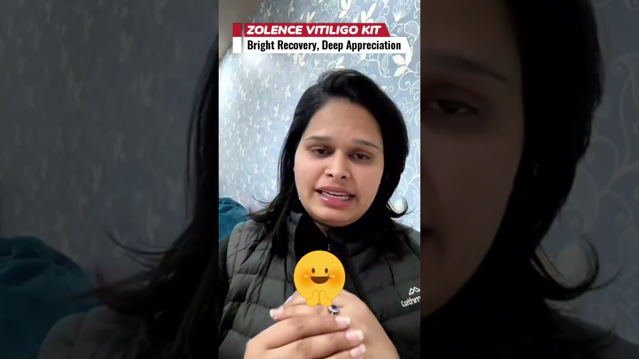 Happy Patient Review: Vitiligo Cure with Zolence Vitiligo Cream – Effective Treatment for Vitiligo