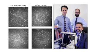 Corneal confocal microscopy image selection (2/3)