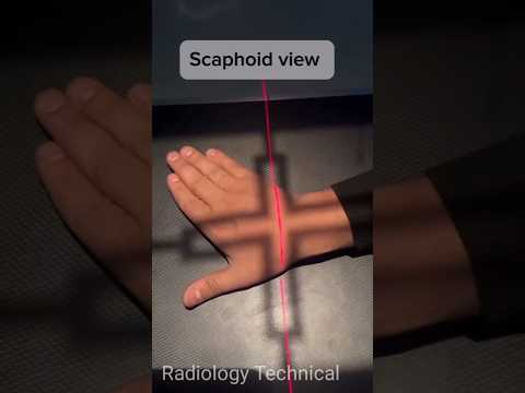 Scaphoid view #