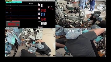 Oxygenator Failure and Replacement (PRONTO method)