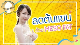 ลดต้นแขน ด้วย MESO FAT I รีวิวลูกสาวหมอ Sowon Clinic EP. 26 ลดต้นแขน ด้วย MESO FAT I รีวิวลูกสาวหมอ Sowon Clinic EP. 26