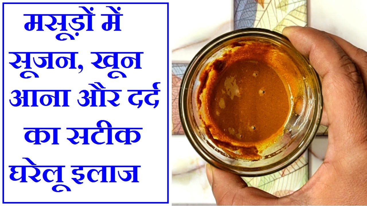 मसूड़ों में सूजन, खून आना और मसूड़ों में होने वाले दर्द का रामबाण घरेलू इलाज || Gum pain problem