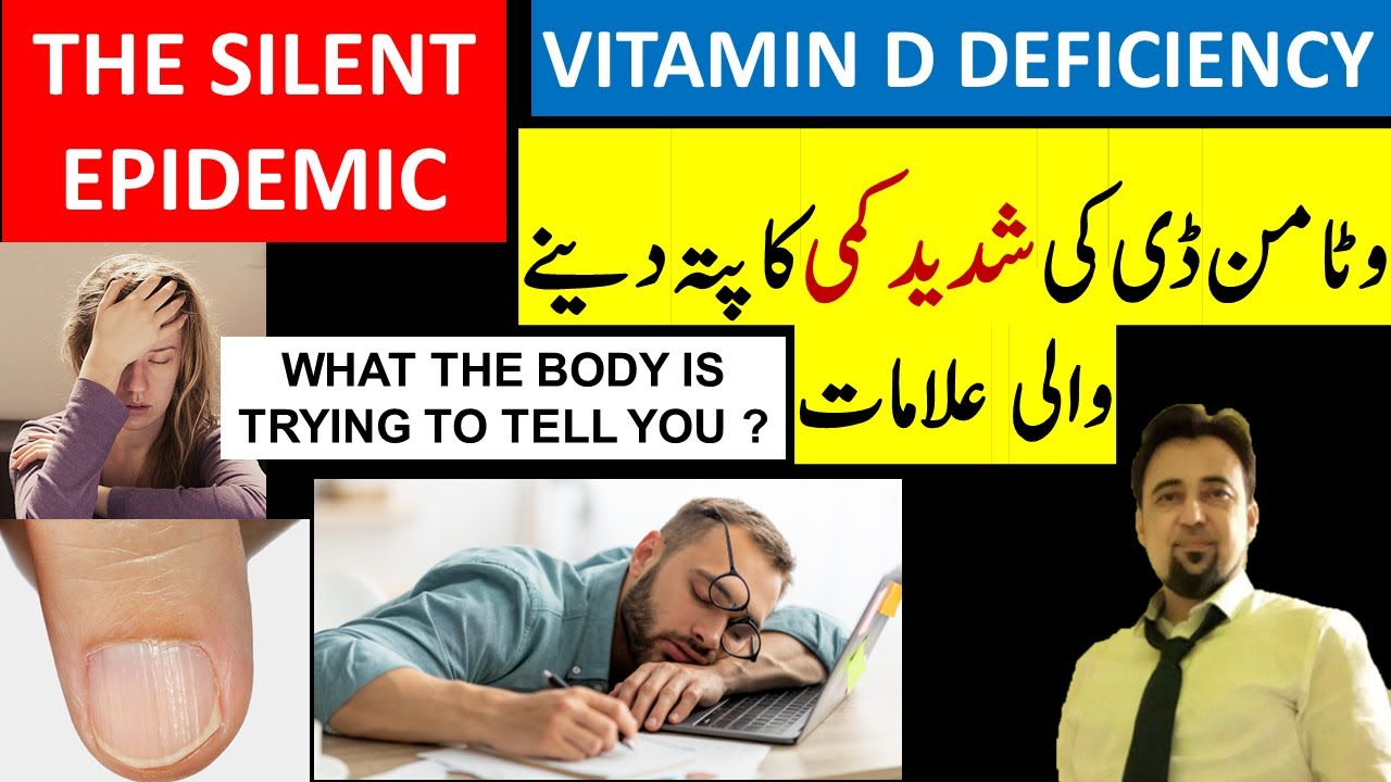 Vitamin D Deficiency Signs The Silent Epidemic YouTube