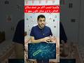 بكتيريا تصيب أكثر من نصف سكان العالم يا ترى ممكن تكون منهم 