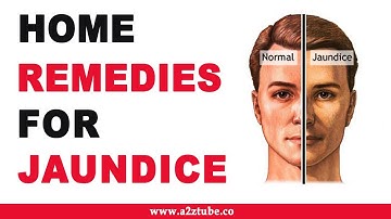 Home Remedies for Jaundice – Natural and Ayurvedic
