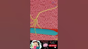 Migraine Treatment: How does it work?