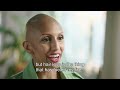 Reflections of Alopecia Areata