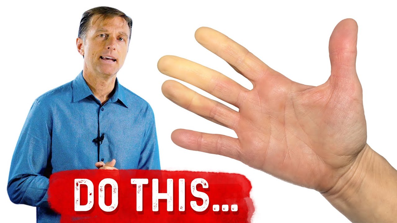 Raynauds Syndrome What Can you do for Raynaud's Syndrome Dr.Berg