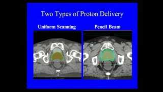 IPCR 2014 Symposium: Advances in Managing Localized Prostate Cancer Part 2